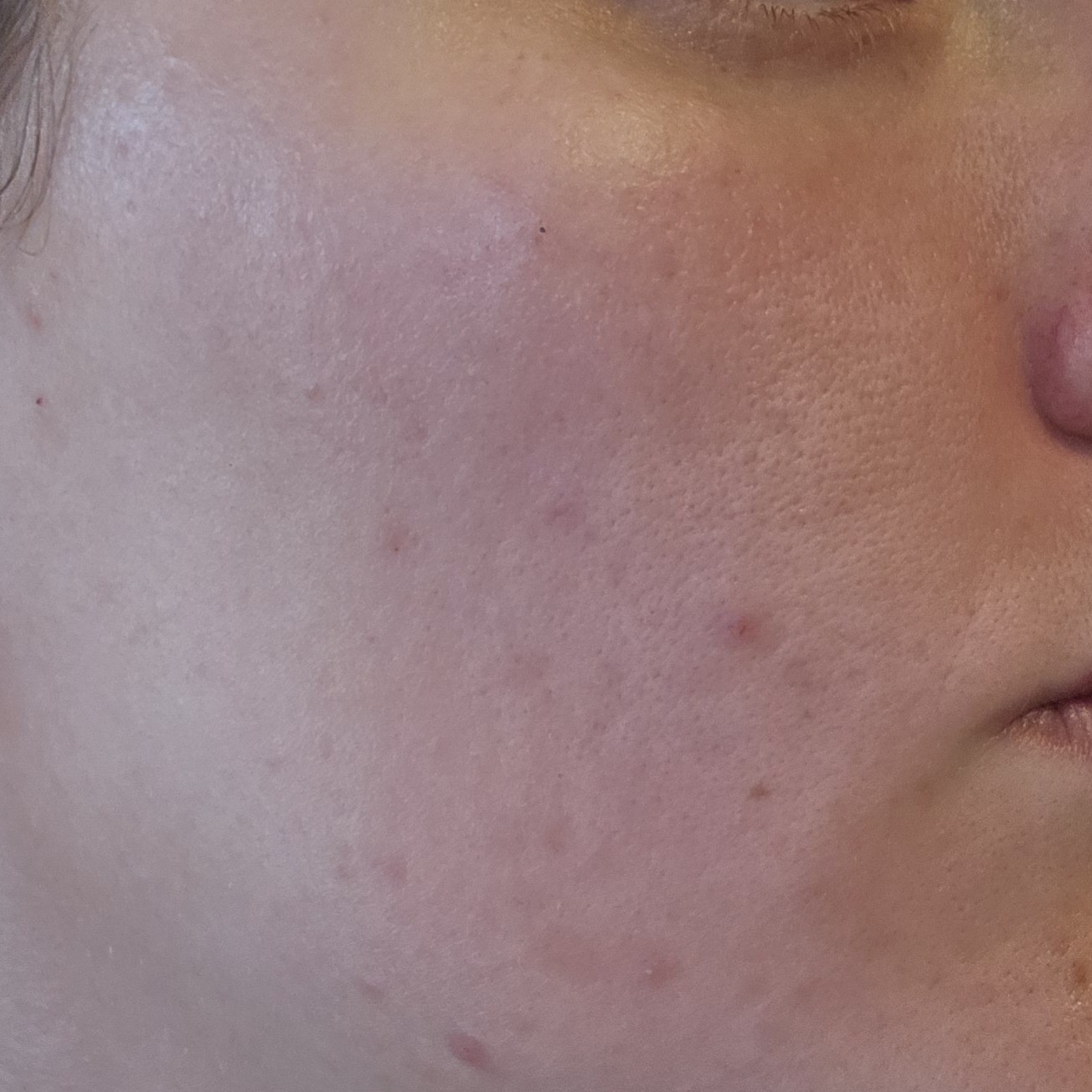 Before using Skinfood Rice Mask Wash Off Pack