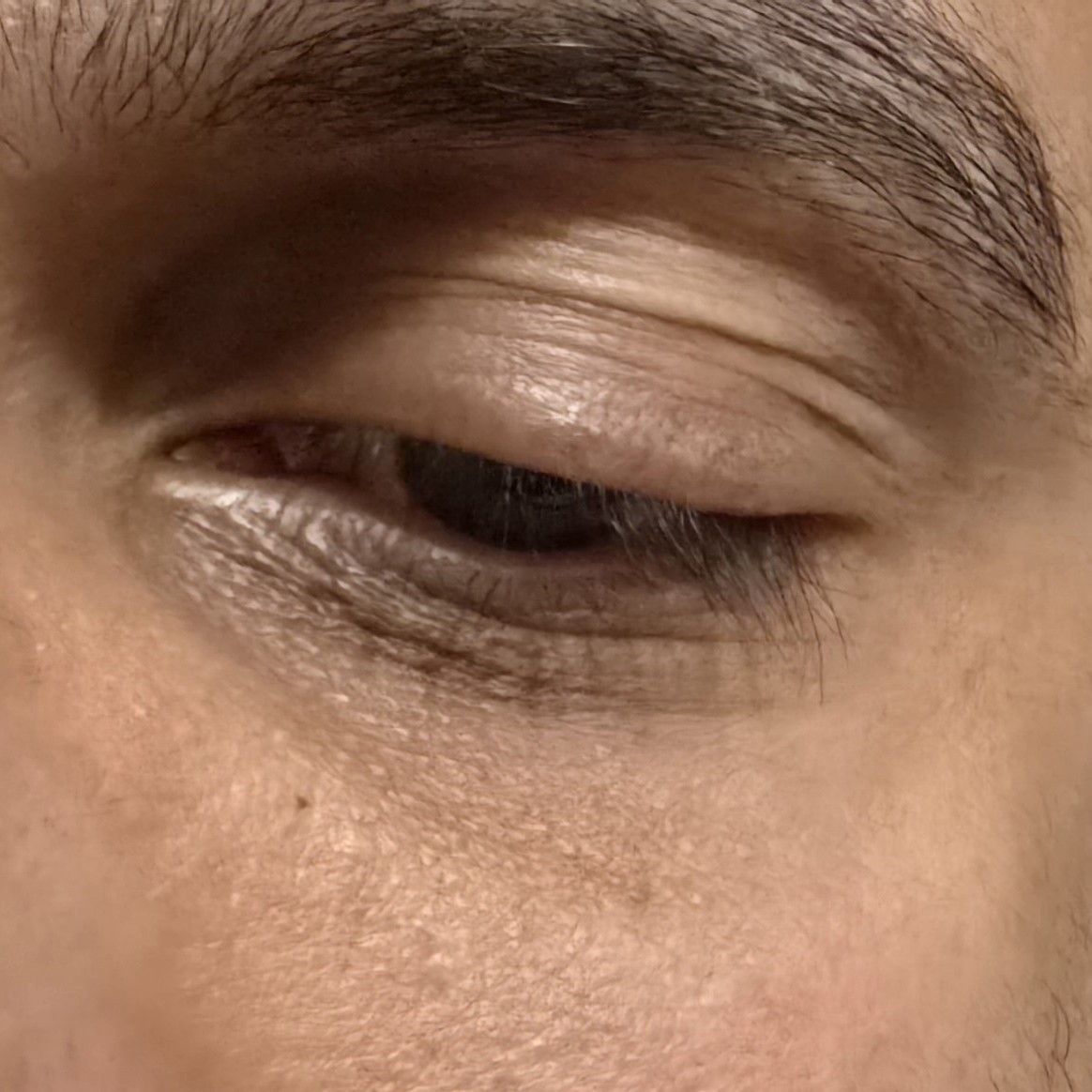 Celimax Vita-A Retinal Shot Tightening Booster Before Shot - Review