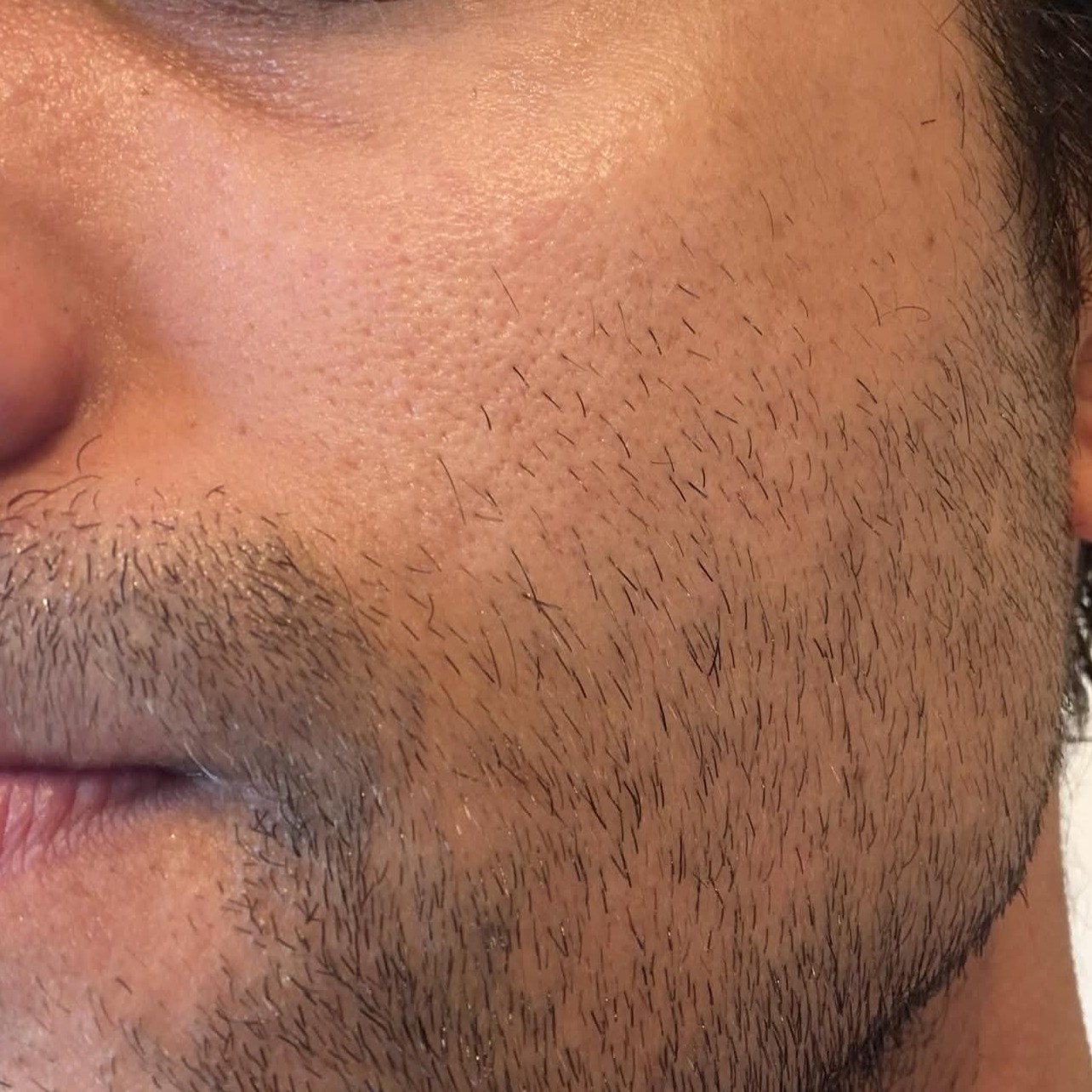 After using Axis Y TXA 2.5% Intensive Brightening Cream