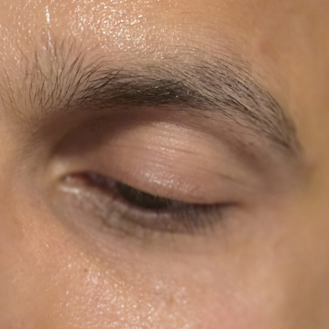 Celimax Vita-A Retinal Shot Tightening Booster After Shot - Review