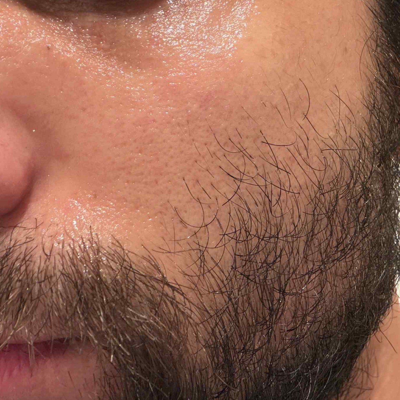 Before using Axis Y TXA 2.5% Intensive Brightening Cream