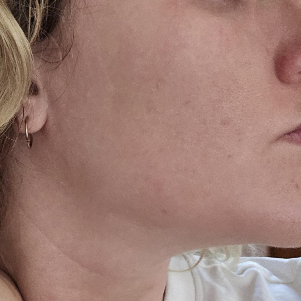 Before using Heimish Black Tea Mask Pack