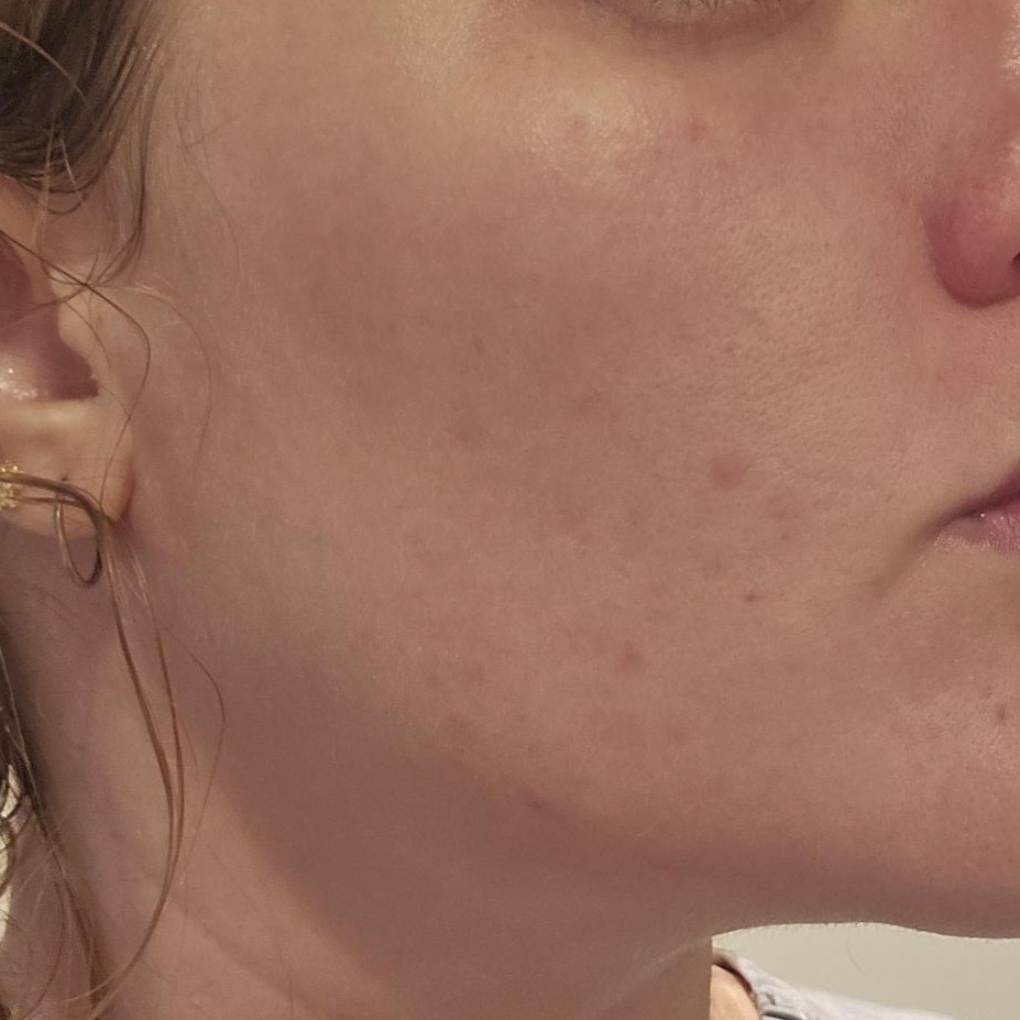 After using Heimish Black Tea Mask Pack